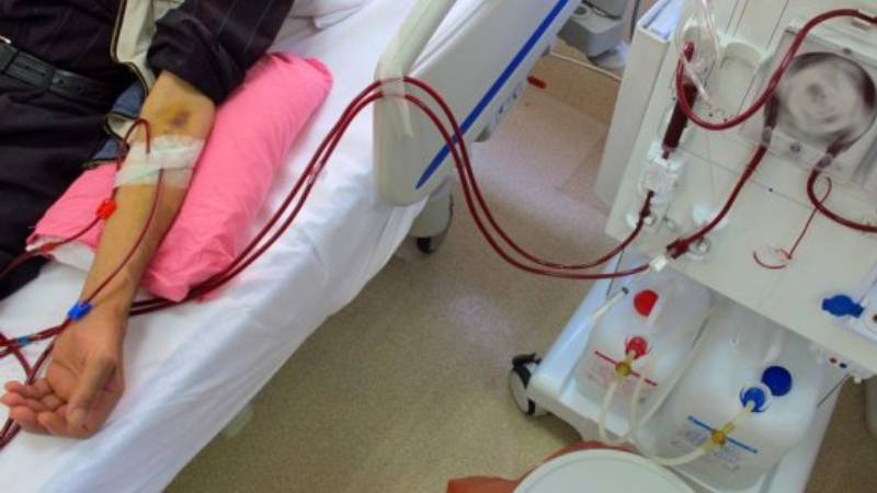 turk bobrek vakfi diyaliz hastalarinda her sene 3 bin civarinda artis oluyor e47SUnkD.jpg